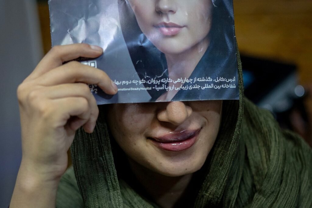 O femeie afgană își acoperă ochii pentru a evita să fie identificată după ce a suferit o procedură de agumentare a buzelor în Kabul.