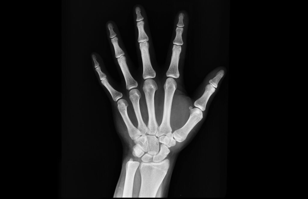 Microplasticele, efect neașteptat asupra oaselor