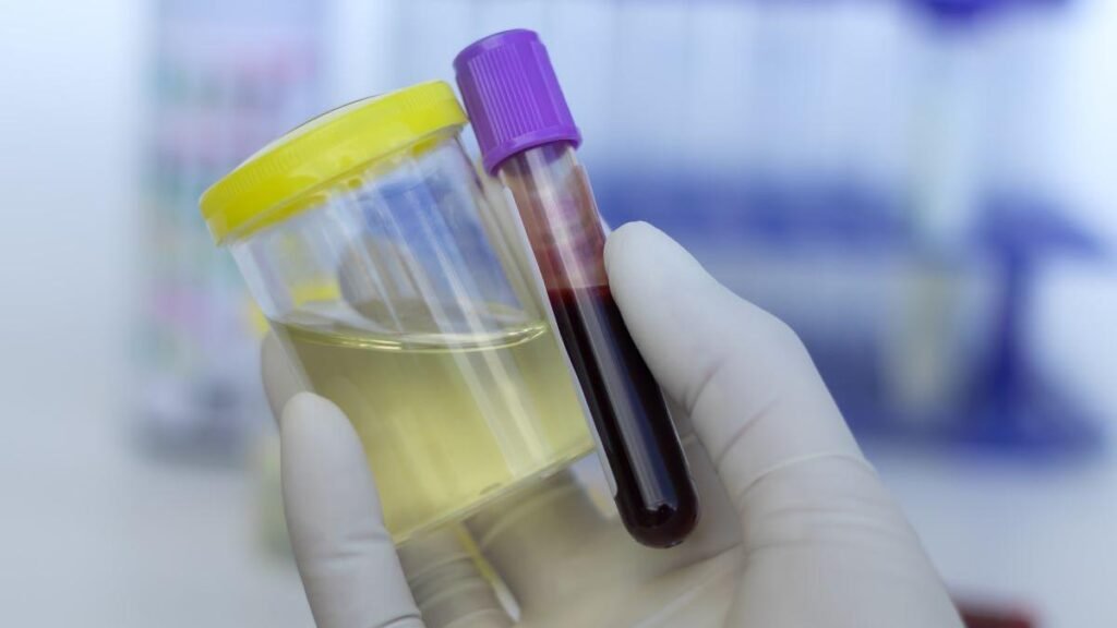 analizele de sânge, direct la medicul de familie